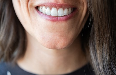 woman smiling with Invisalign tray