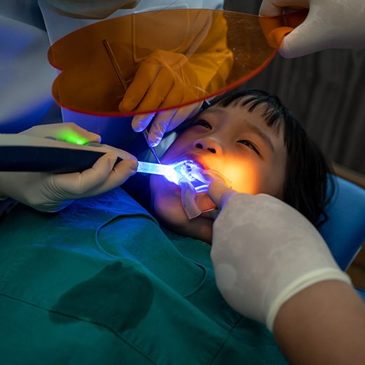 Young child receiving a dental sealant 